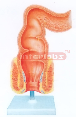 HUMAN HEALTH RECTUM (CORONAL SECTION) MODEL